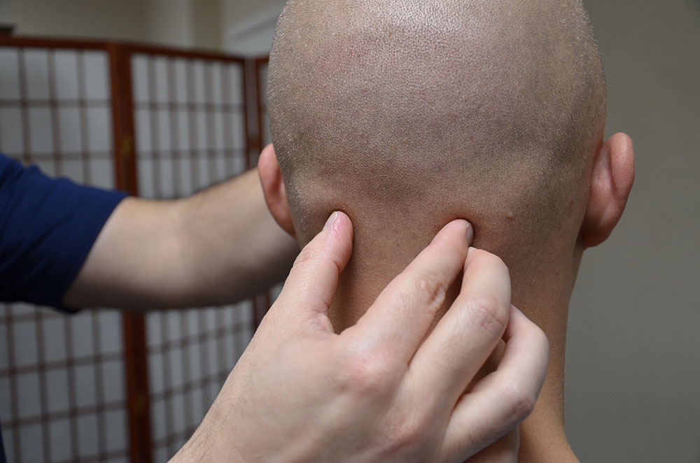 Craniosacral Therapy